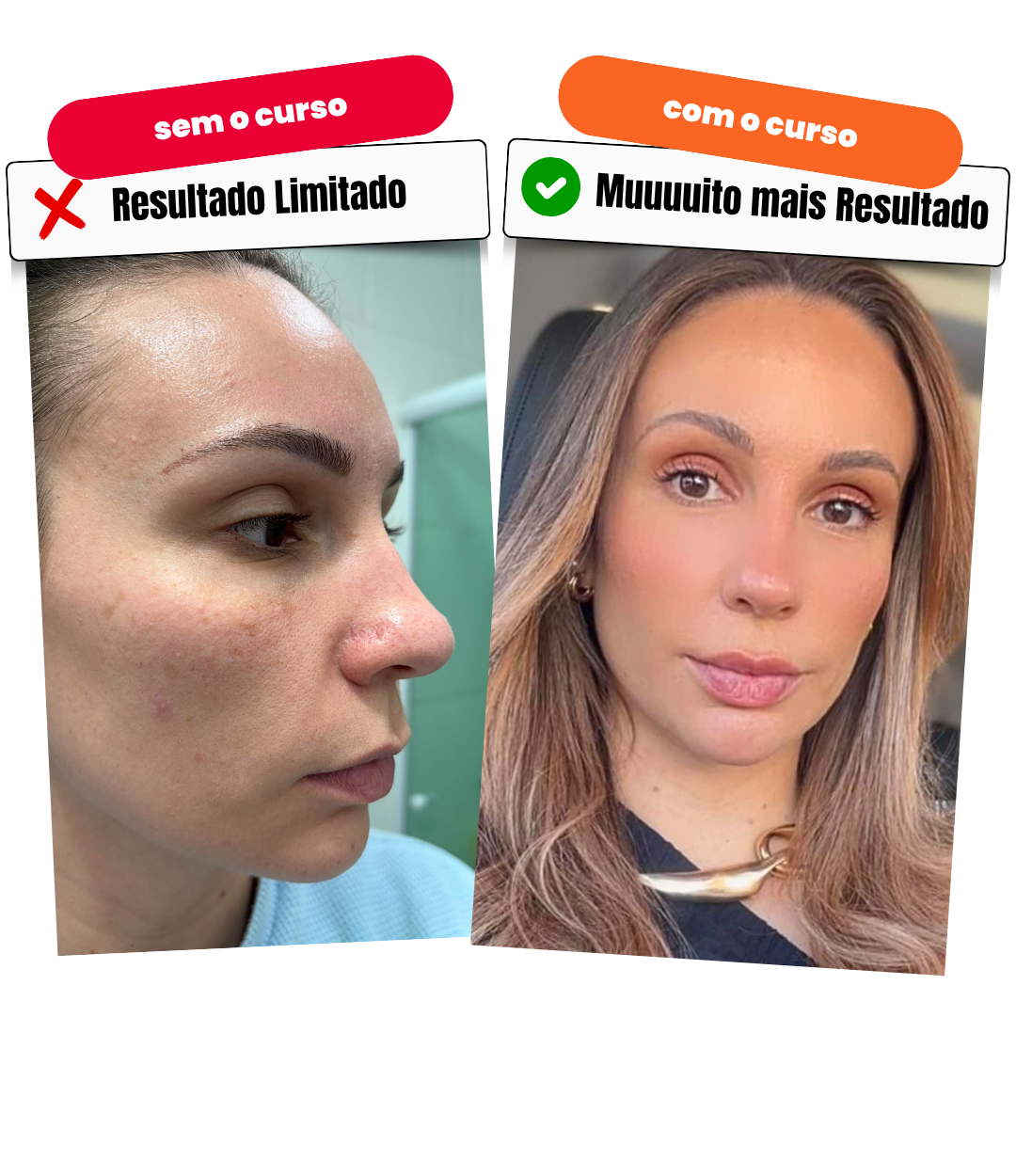 RegeneraSkin